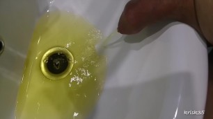 my penis peeing into the sink with yellow urine